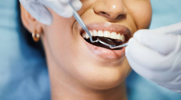 Best Emergency Dental Care for Abscessed Tooth in Riverview, MI